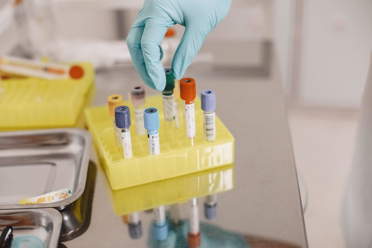 Bancada de laboratório onde o exame de sangue é processado