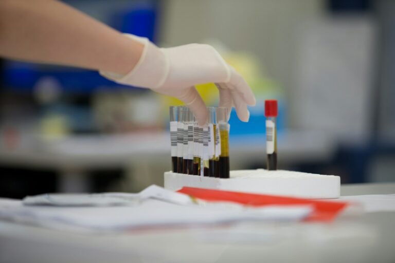 Tubo de ensaio com amostra de sangue para hemograma completo