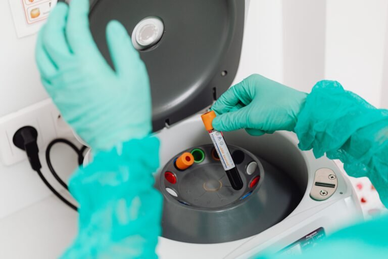 Resultado de exame de sangue com PCR alto