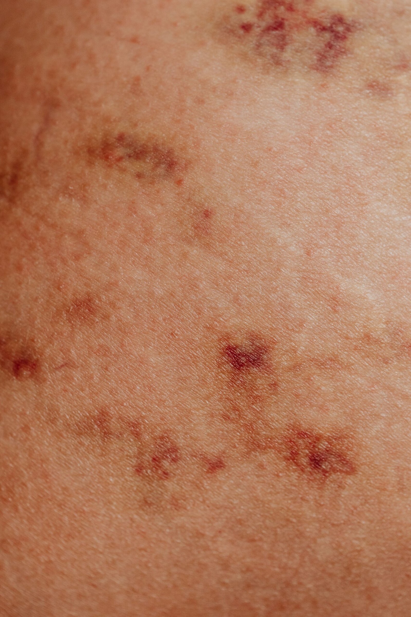 Dois tubos de sangue para PCR ou VHS sobre um pedido de exame