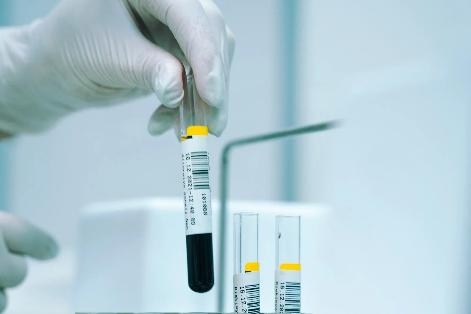 Tubo de sangue usado no exame de VHS, a velocidade de hemossedimentação