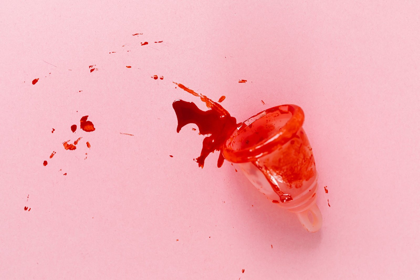 Laudo de exame de sangue com ureia alta destacada