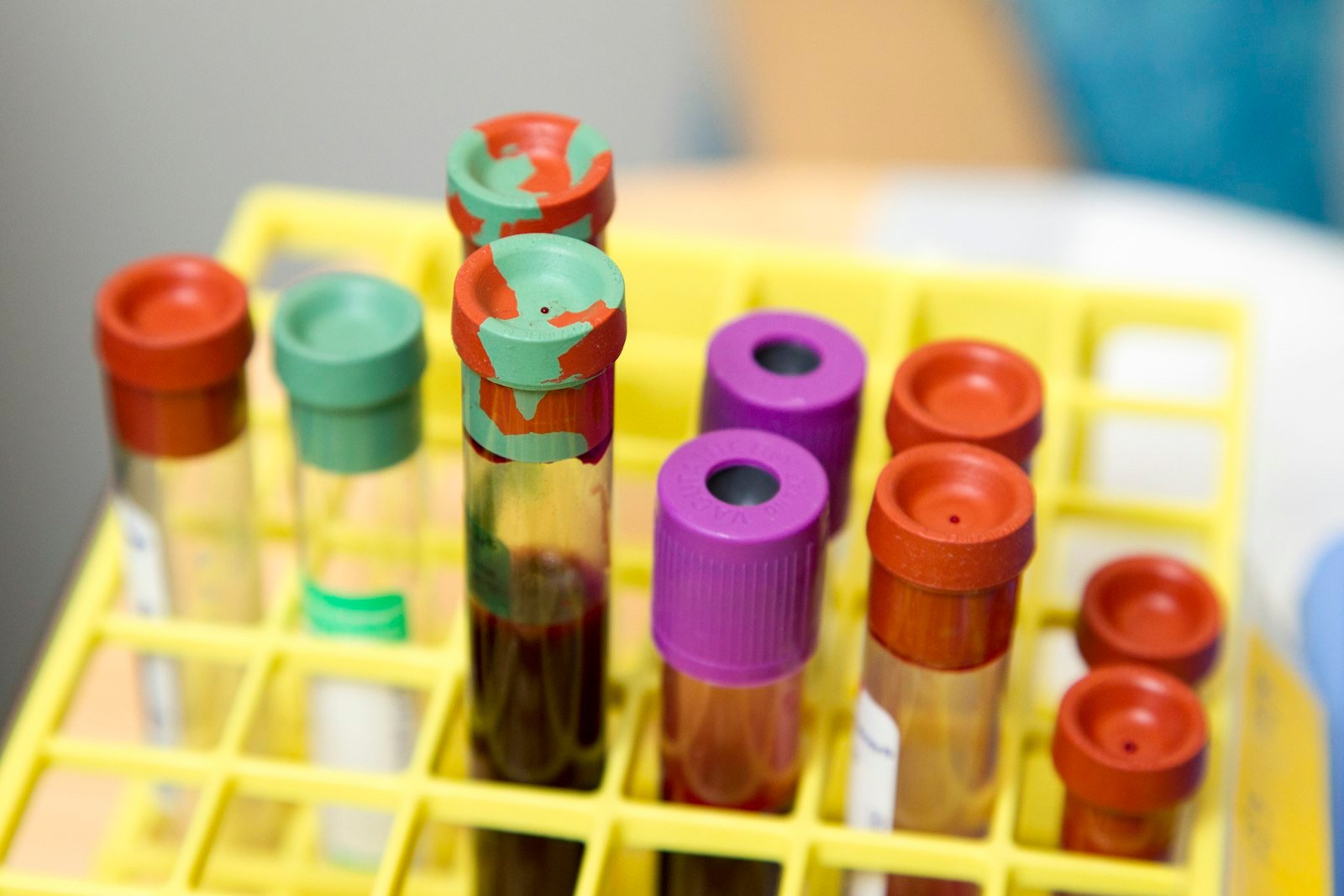 Tubos de laboratório usados na dosagem de eletrólitos no sangue