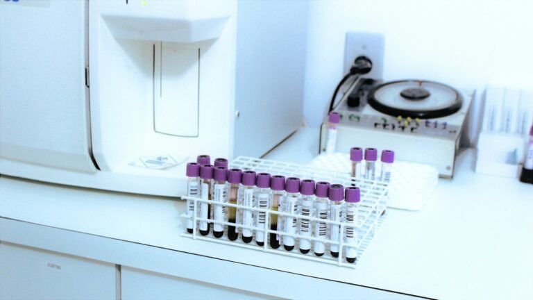 Analisador de laboratório usado para dosar TGO e TGP
